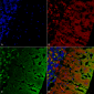 Alpha Synuclein Antibody